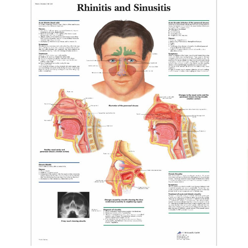 Aparelho de Tratamento da Rinite e Sinusite - Bionase Esfera